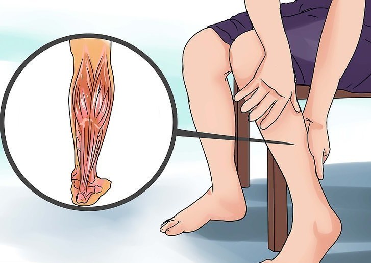 Recovery time for torn calf muscle - Medical Experts