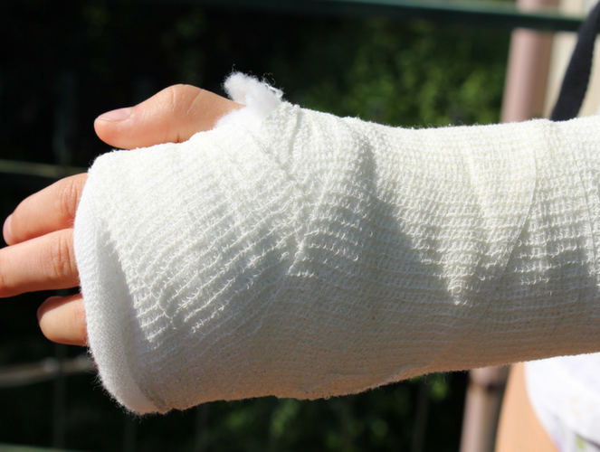 New in a Plaster Cast? Advice On How To Speed Up Recovery